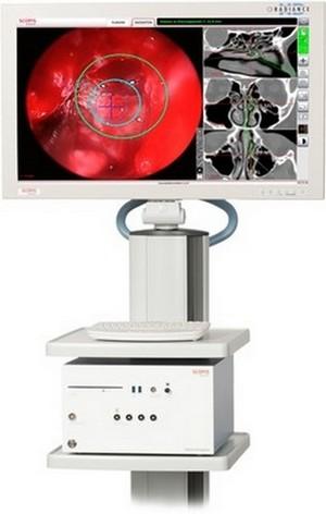 hệ thống định vị trong mổ